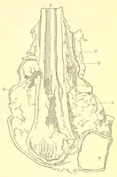 An illustration from The American journal of the medical sciences (1827)