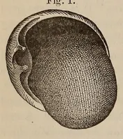 An illustration from The American journal of the medical sciences (1827)