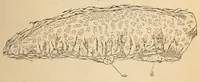 An illustration from The American journal of the medical sciences (1827)