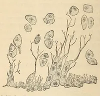 Picture 6 of 18 from The American journal of the medical sciences (1827), leaf 362