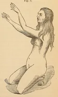 An illustration from The American journal of the medical sciences (1827)