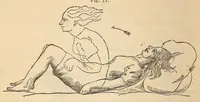 Picture 13 of 18 from The American journal of the medical sciences (1827), leaf 408