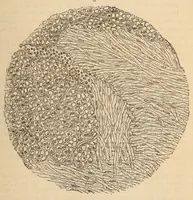 An illustration from The American journal of the medical sciences (1827)