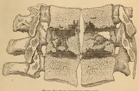An illustration from The American journal of the medical sciences (1827)