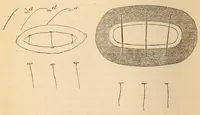 An illustration from The American journal of the medical sciences (1827)
