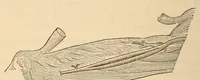 An illustration from The American journal of the medical sciences (1827)
