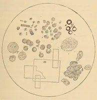 An illustration from The American journal of the medical sciences (1827)