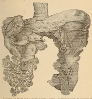 An illustration from The American journal of the medical sciences (1827)