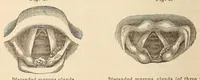 Picture 6 of 16 from The American journal of the medical sciences (1827), leaf 130