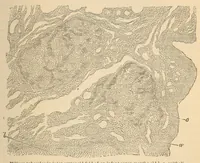 Picture 8 of 16 from The American journal of the medical sciences (1827), leaf 137