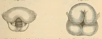 An illustration from The American journal of the medical sciences (1827)