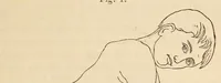 Picture 12 of 16 from The American journal of the medical sciences (1827), leaf 413