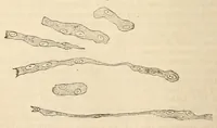 Picture 13 of 16 from The American journal of the medical sciences (1827), leaf 442