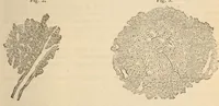 An illustration from The American journal of the medical sciences (1827)