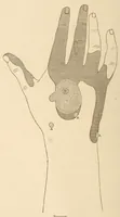 An illustration from The American journal of the medical sciences (1827)