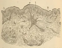 An illustration from The American journal of the medical sciences (1827)