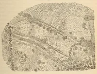 Picture 13 of 17 from The American journal of the medical sciences (1827), leaf 123