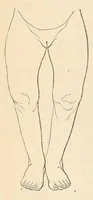 An illustration from The American journal of the medical sciences (1827)