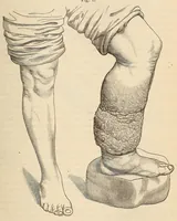 An illustration from The American journal of the medical sciences (1827)
