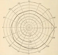 Picture 17 of 17 from The American journal of the medical sciences (1827), leaf 454