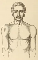 An illustration from The American journal of the medical sciences (1827)
