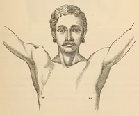 An illustration from The American journal of the medical sciences (1827)