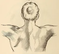 An illustration from The American journal of the medical sciences (1827)
