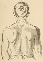 An illustration from The American journal of the medical sciences (1827)