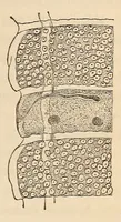 An illustration from The American journal of the medical sciences (1827)