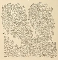 An illustration from The American journal of the medical sciences (1827)