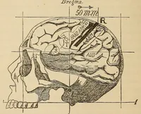 An illustration from The American journal of the medical sciences (1827)