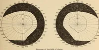 An illustration from The American journal of the medical sciences (1827)