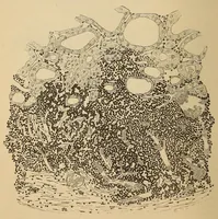 An illustration from The American journal of the medical sciences (1827)