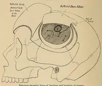 Picture 4 of 15 from The American journal of the medical sciences (1827), leaf 52