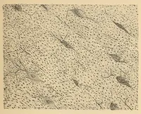 An illustration from The American journal of the medical sciences (1827)