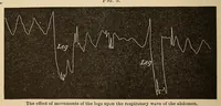 An illustration from The American journal of the medical sciences (1827)