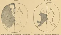 Picture 13 of 15 from The American journal of the medical sciences (1827), leaf 697