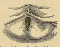 An illustration from The American journal of the medical sciences (1827)