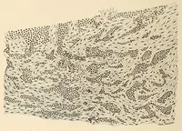 An illustration from The American journal of the medical sciences (1827)