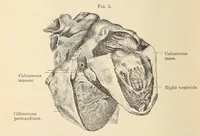 An illustration from The American journal of the medical sciences (1827)