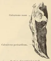 Picture 5 of 14 from The American journal of the medical sciences (1827), leaf 168