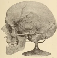 An illustration from The American journal of the medical sciences (1827)