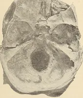 An illustration from The American journal of the medical sciences (1827)