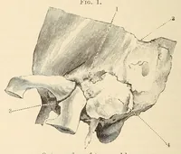 An illustration from The American journal of the medical sciences (1827)