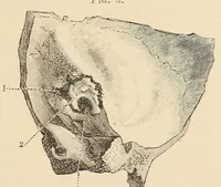 An illustration from The American journal of the medical sciences (1827)