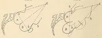 An illustration from The American journal of the medical sciences (1827)