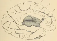 An illustration from The American journal of the medical sciences (1827)