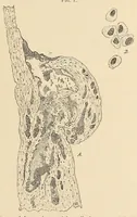 An illustration from The American journal of the medical sciences (1827)