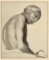 An illustration from The American journal of the medical sciences (1827)