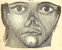 An illustration from The American journal of the medical sciences (1827)
